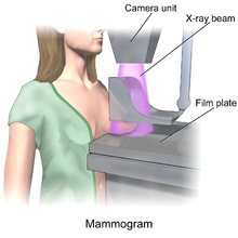 Diagram mamogram